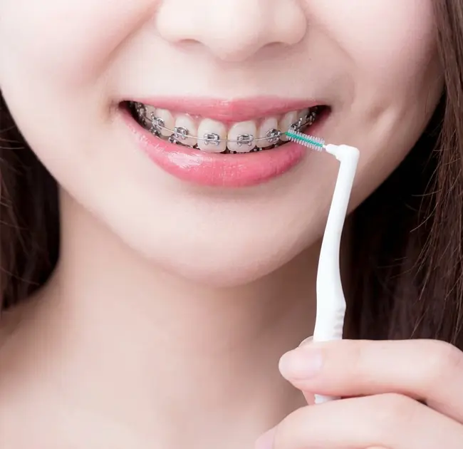 Sikat Interdental Nggawe Pengalaman Anyar babagan Perawatan Oral